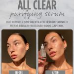 <span class=bbbbb>All Clear Purifying Serum</span><br/><b class=ccccc>Salicylic Acid Face Serum</b> - Image 3